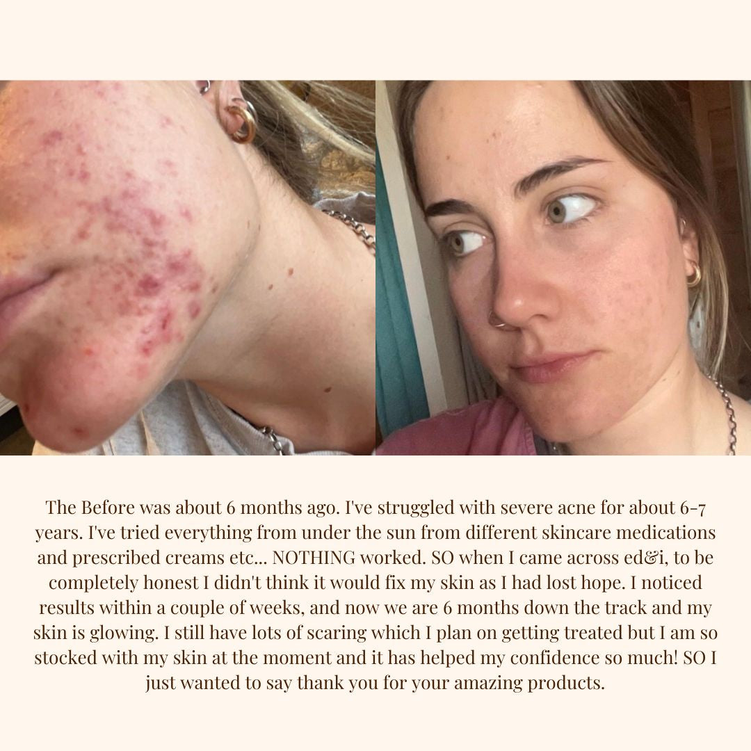 ed&I MORNING COFFEE - Face Scrub & Mask